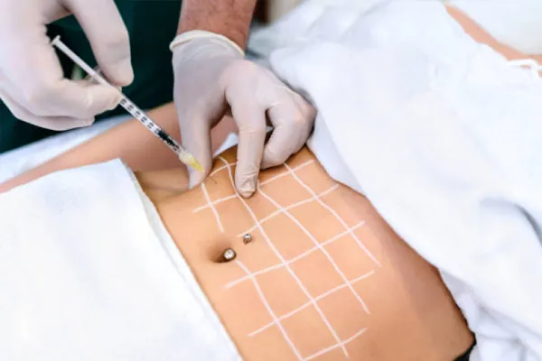 emptiers - esvaziadores de gordura