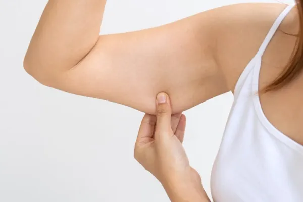 flacidez nos braços