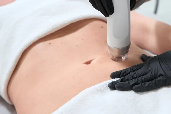 tratamento de flacidez corporal com liftera