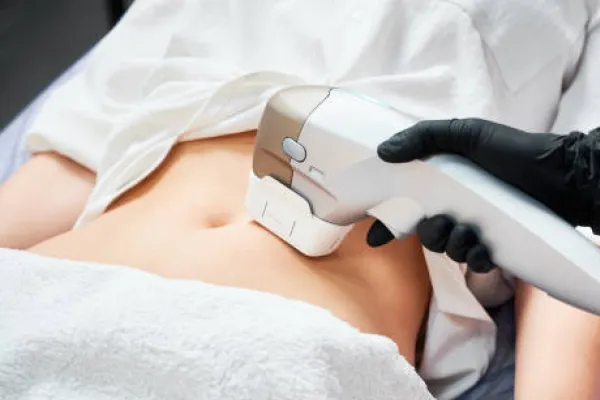 ultraformer no tratamento da flacidez corporal